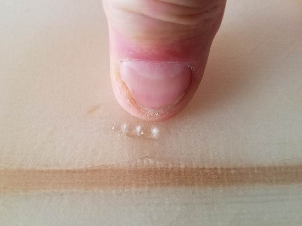 Wax removal revealing water ingress